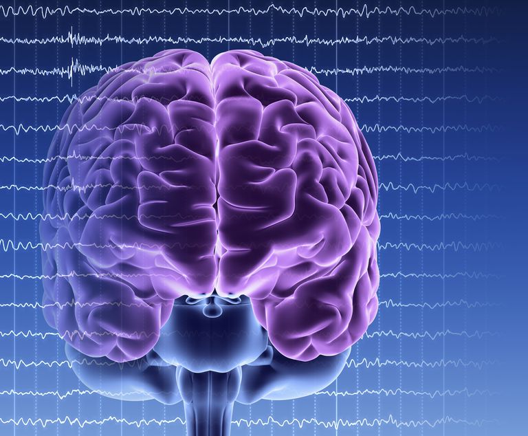 آموزش ویژه مرگ مغزی - Brain Death EEG